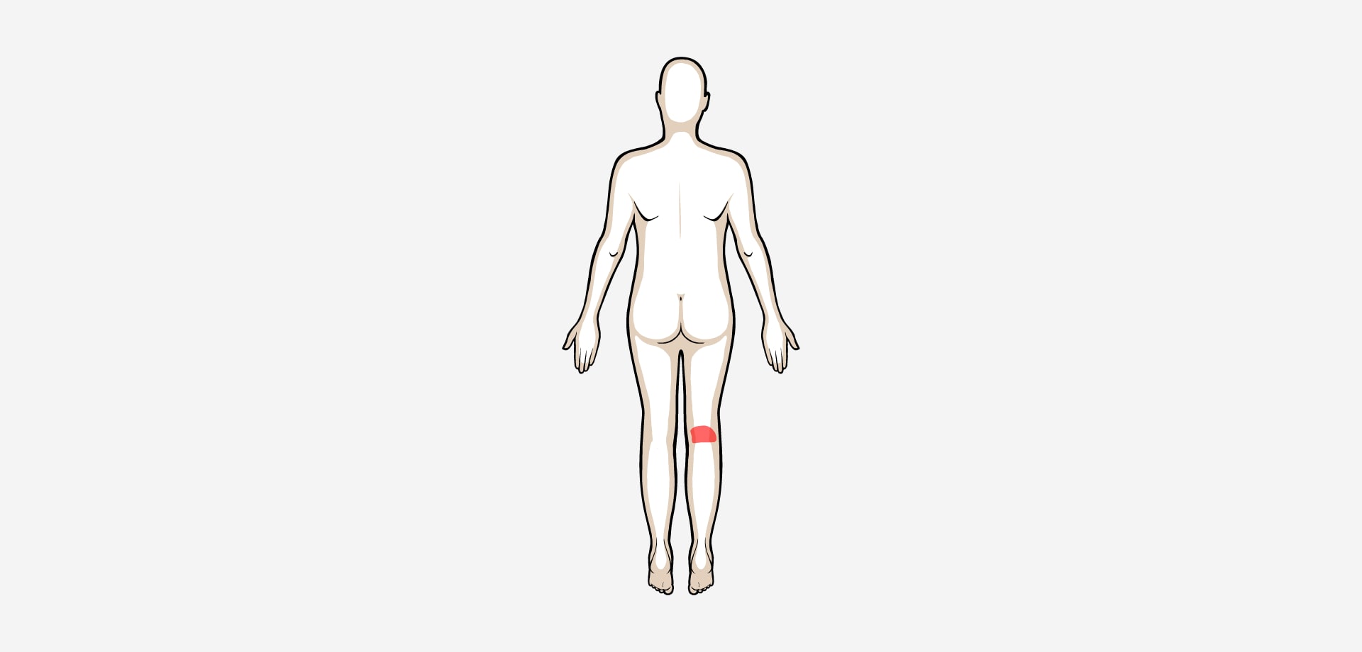 Dolor posterior rodilla